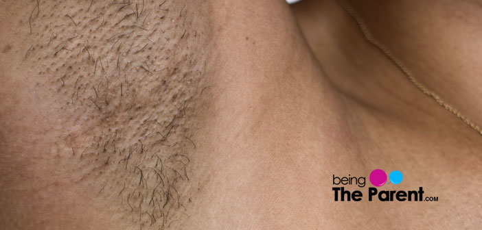 Is It Normal To Have Excess Facial Body Hair During Pregnancy