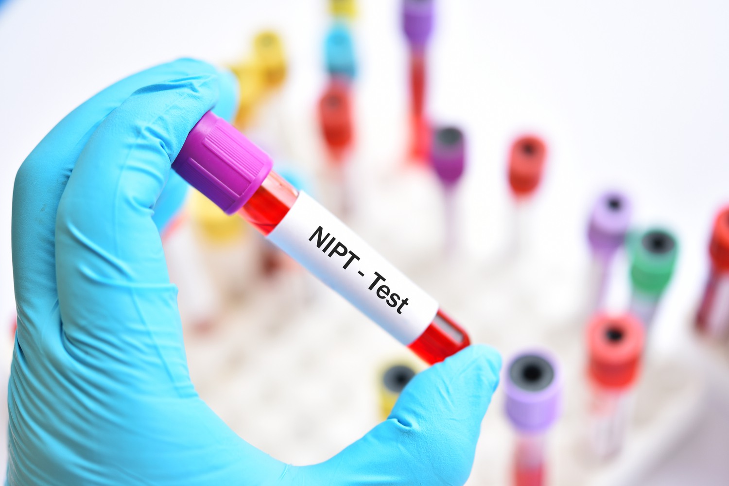 Planning a Baby Get Counselling Done Being The Parent