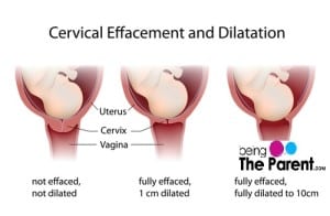 Stages of Labor