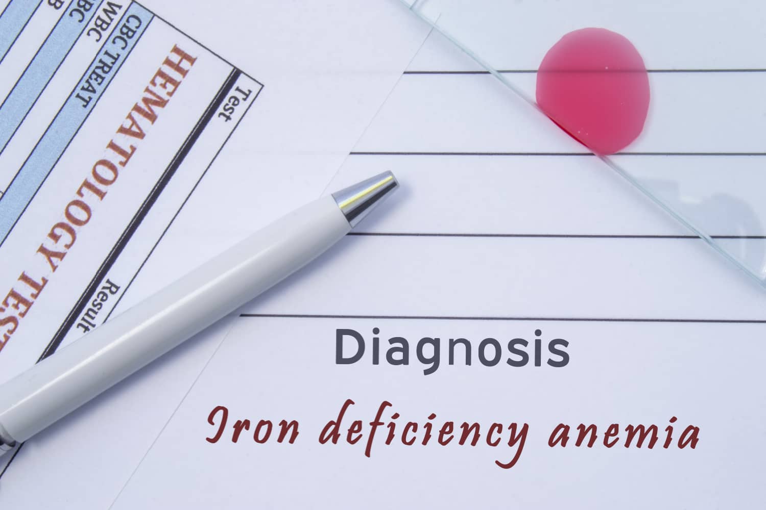 treatment iron deficiency anemia.