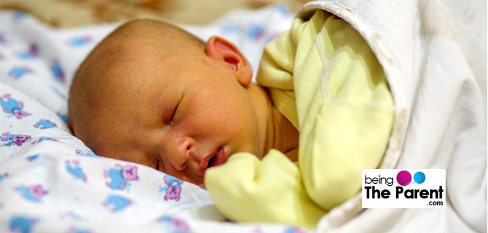 Newborn baby has jaundice