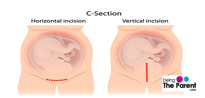 Triple penetration close up