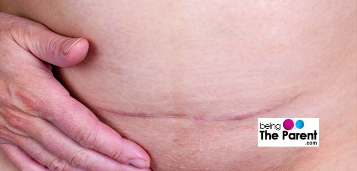 menstruation after c-section breast feeding Wife hidden camera naked