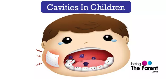 Cavities in children
