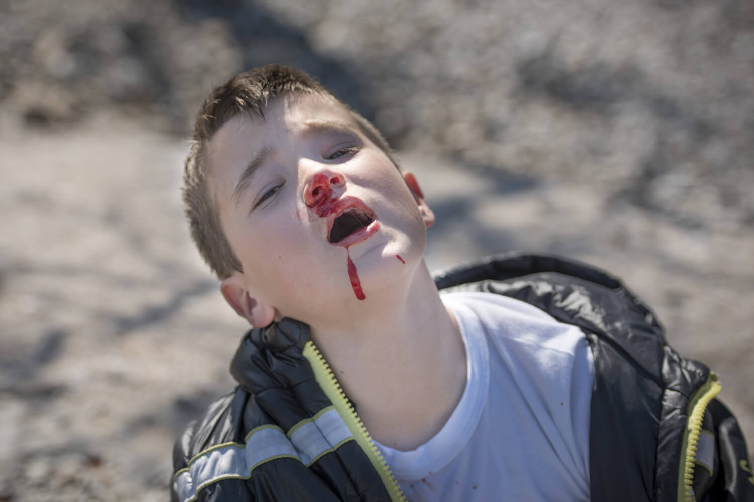 Head Injury Warning Signs In Children