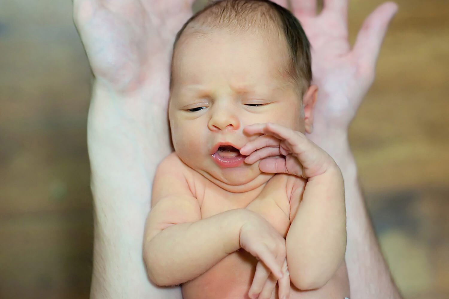 Signs And Symptoms Of Jaundice In Newborn Babies