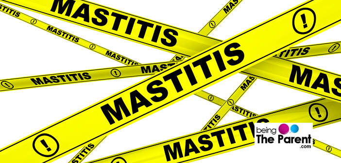 Mastitis