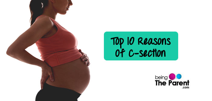 Reasons for a C-section