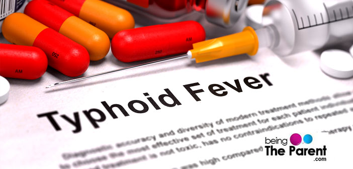 typhoid in pregnancy