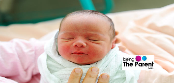 Baby Born With Cone Head