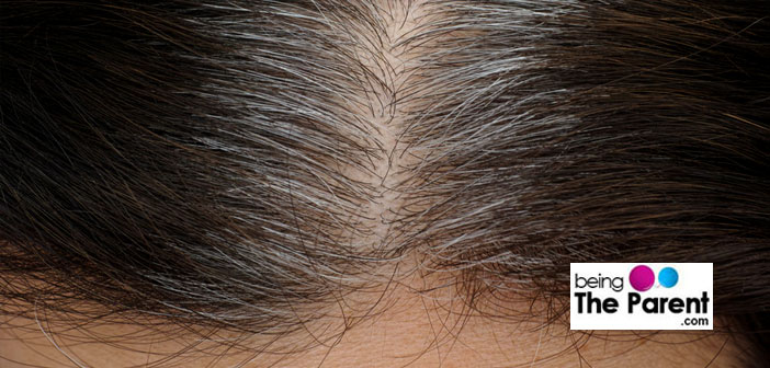 grey hair in children