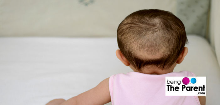 Baby hair loss  BabyCentre