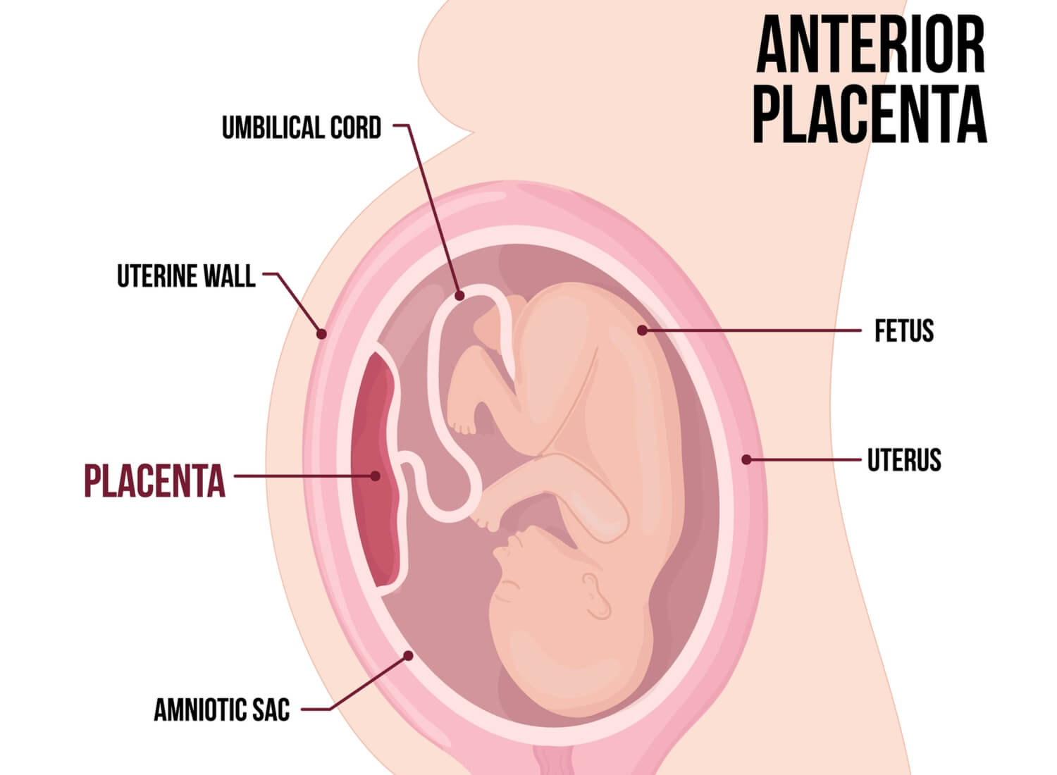 meaning of placenta presentation