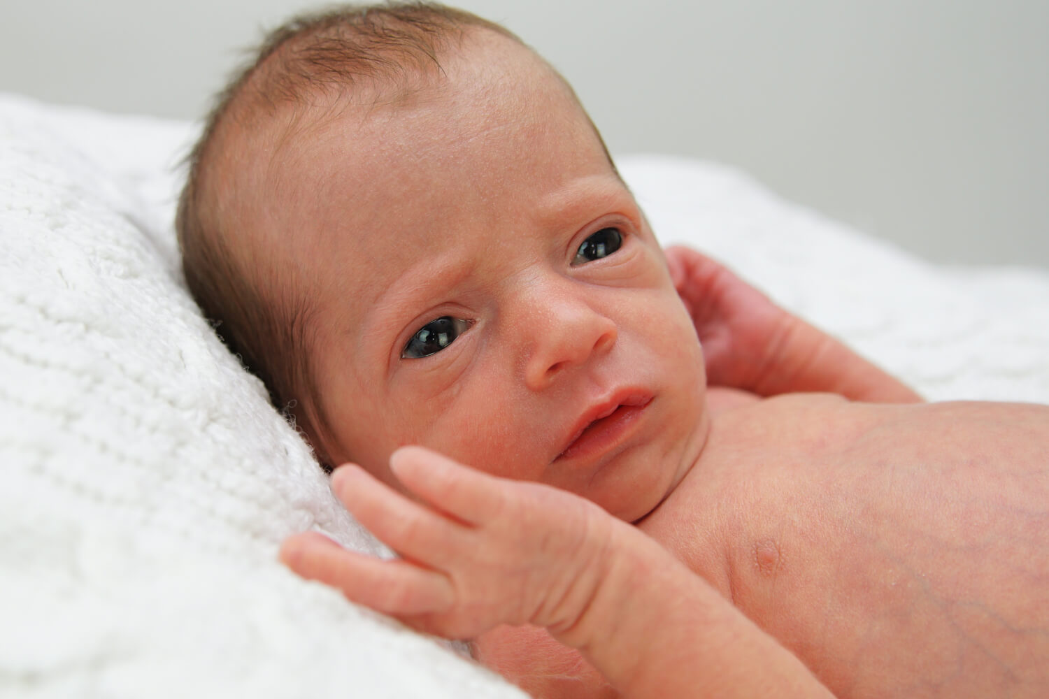 Hemorrhagic Disease of Newborn (VKDB) Causes, Symptoms and Treatment