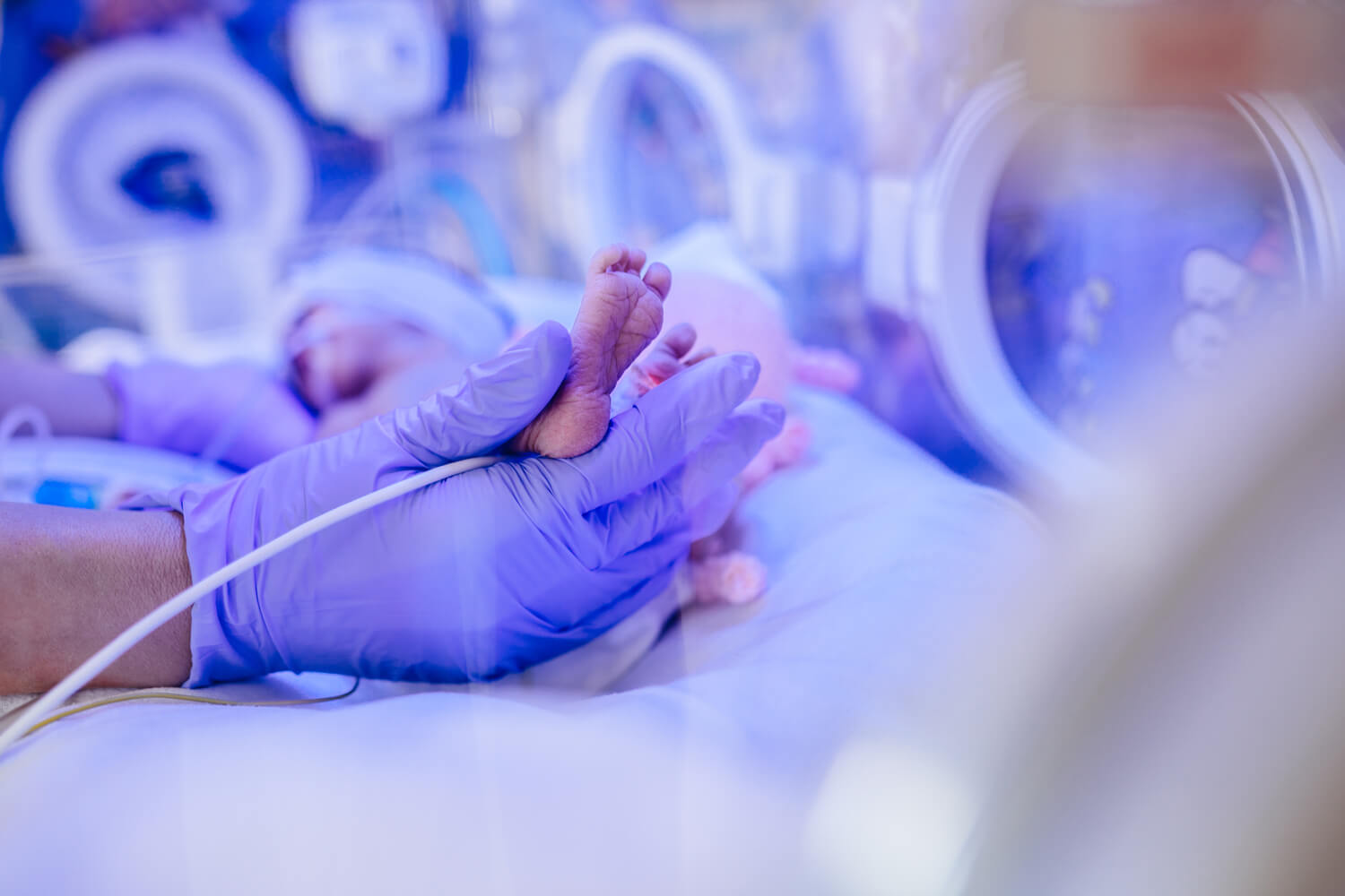 Common Health Issues Of Premature Babies
