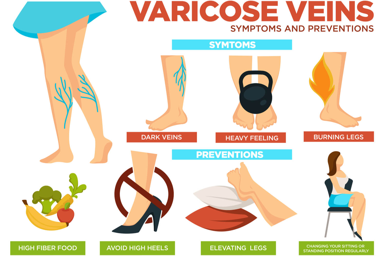 Symptoms of Varicose Veins During Pregnancy