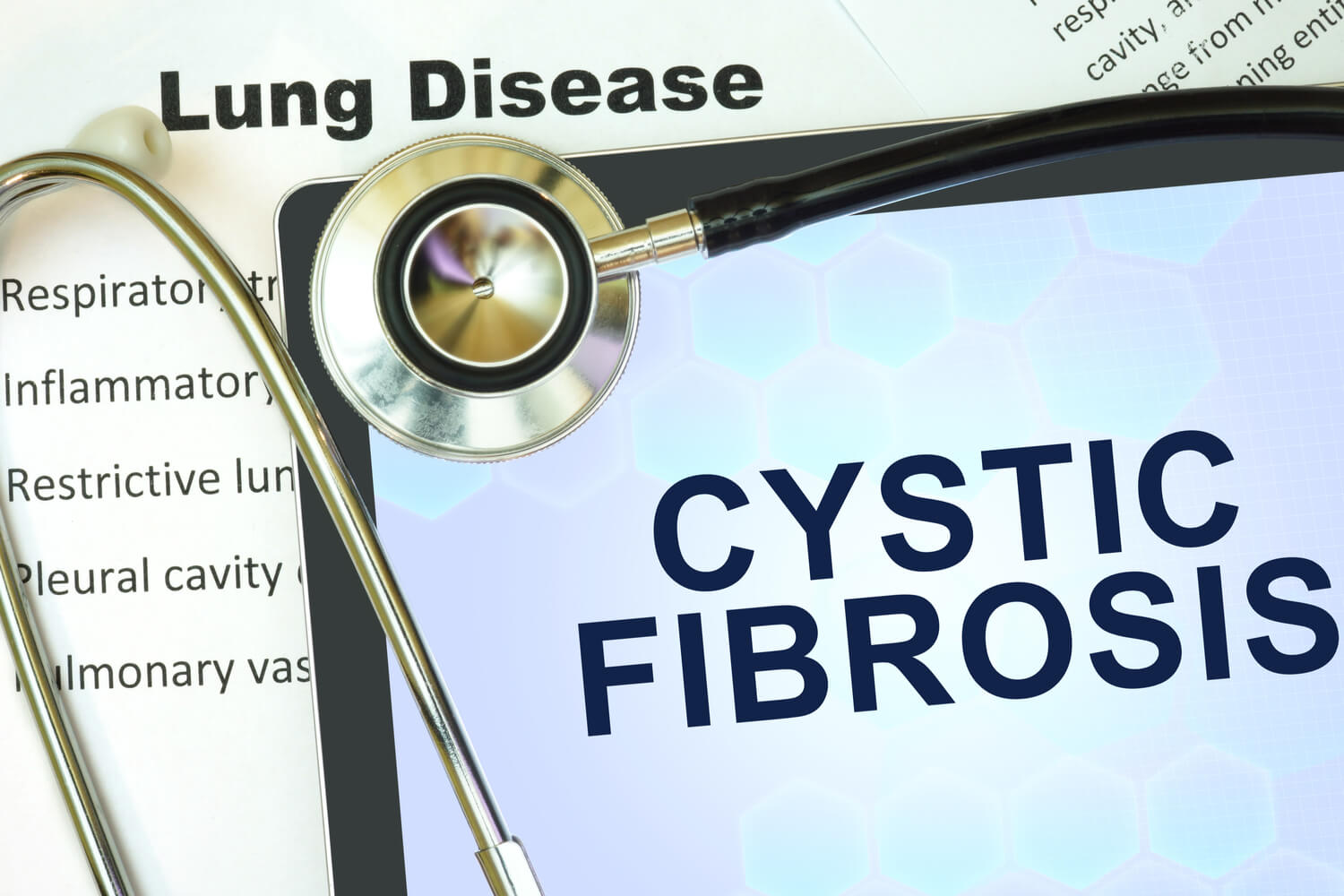 cystic fibrosis