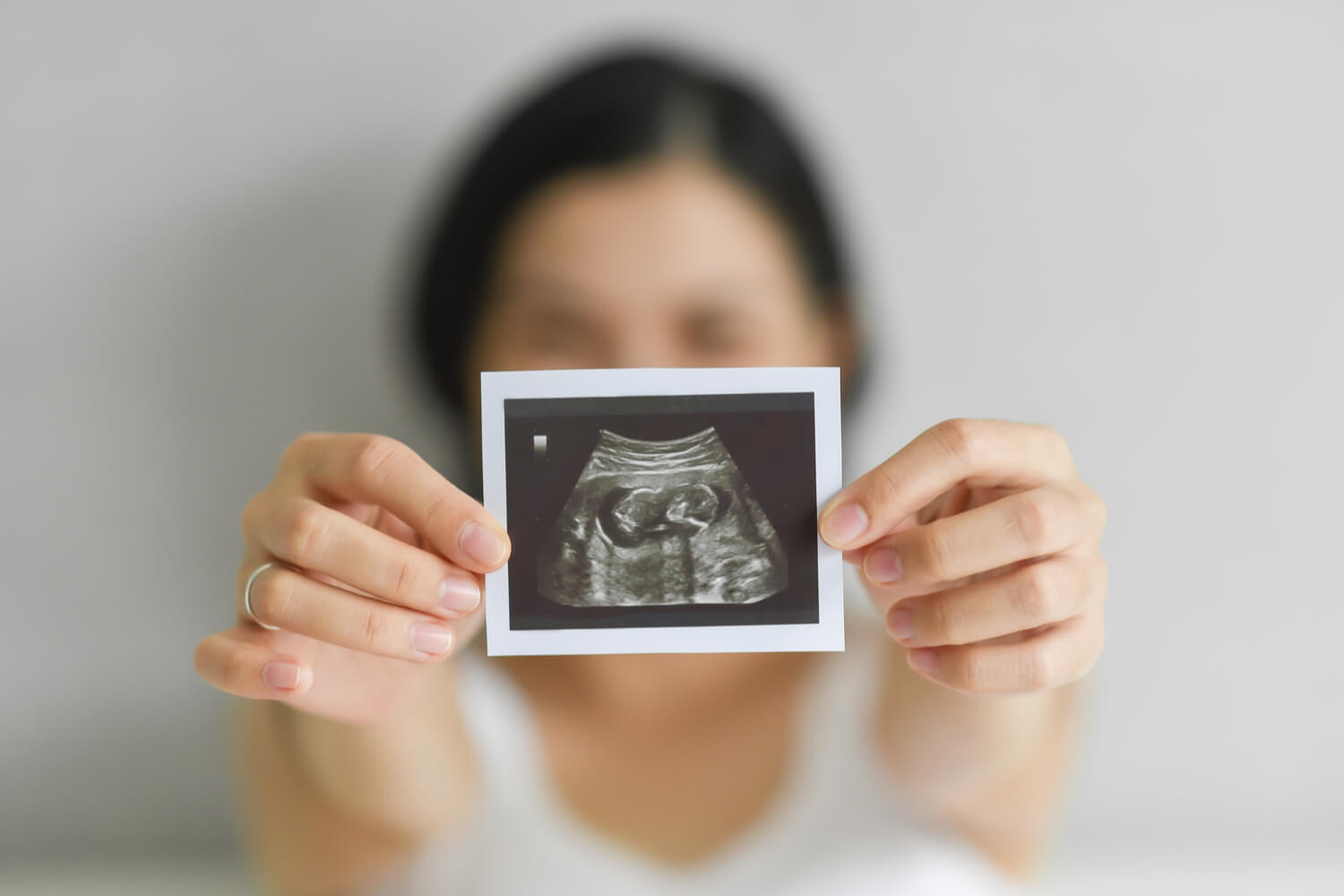 How To Increase Fetal Weight During Pregnancy Being The Parent