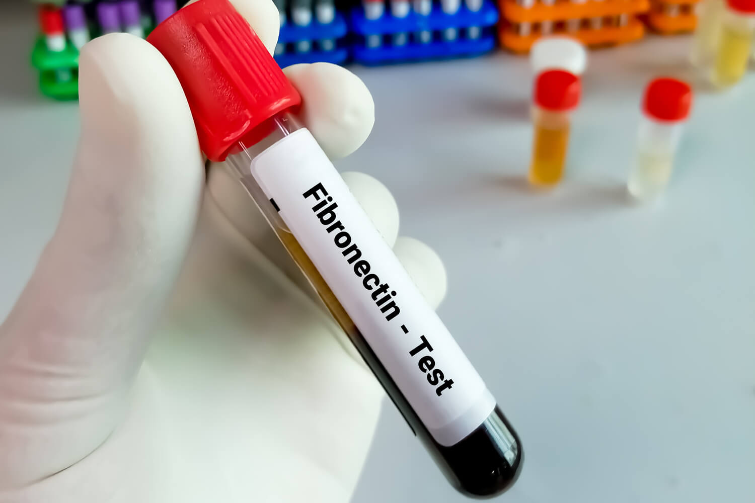 Fetal Fibronectin