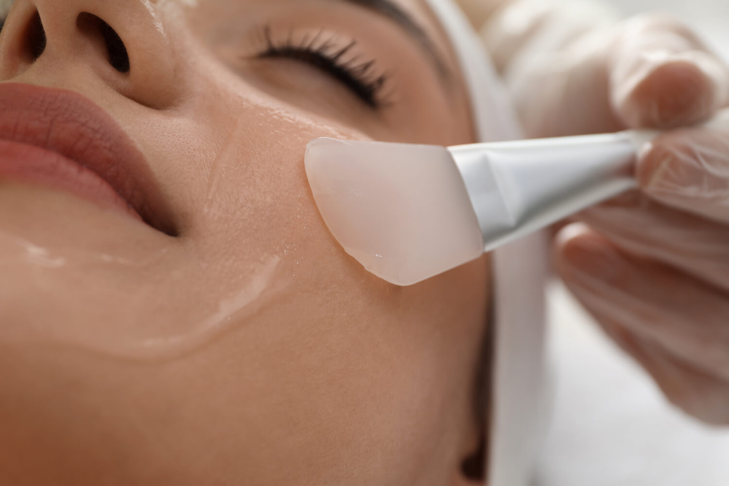 Why Are Chemical Peels Unsafe During Pregnancy_