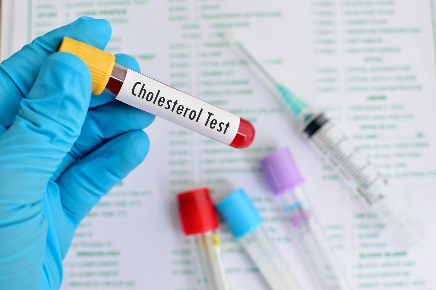 Dealing With High Cholesterol During Pregnancy