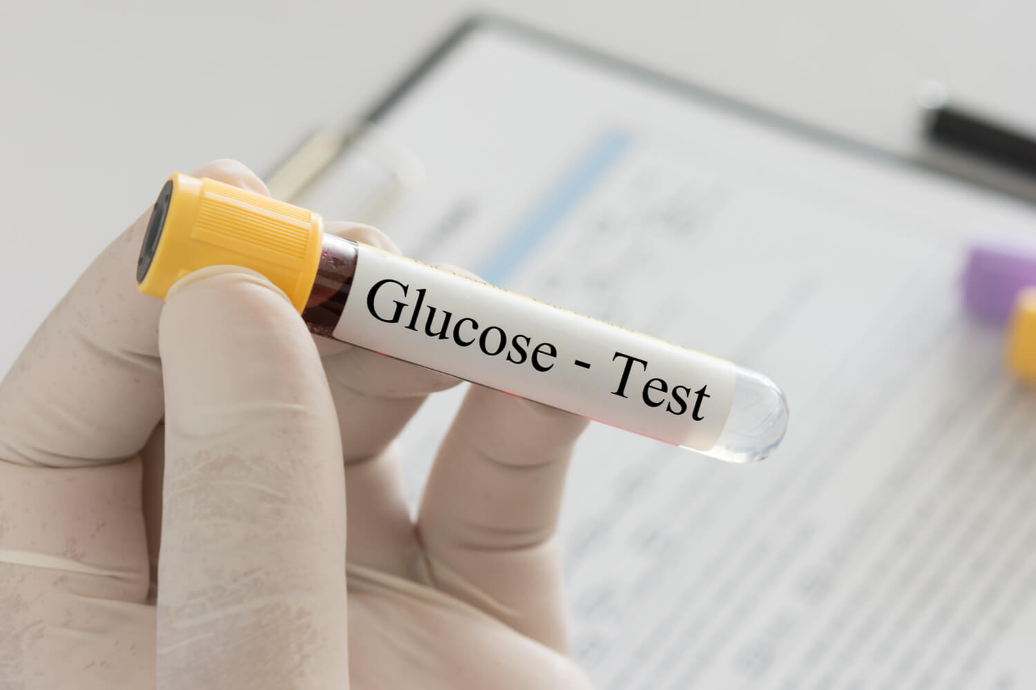 Glucose Screening Test And Glucose Tolerance Test During Pregnancy