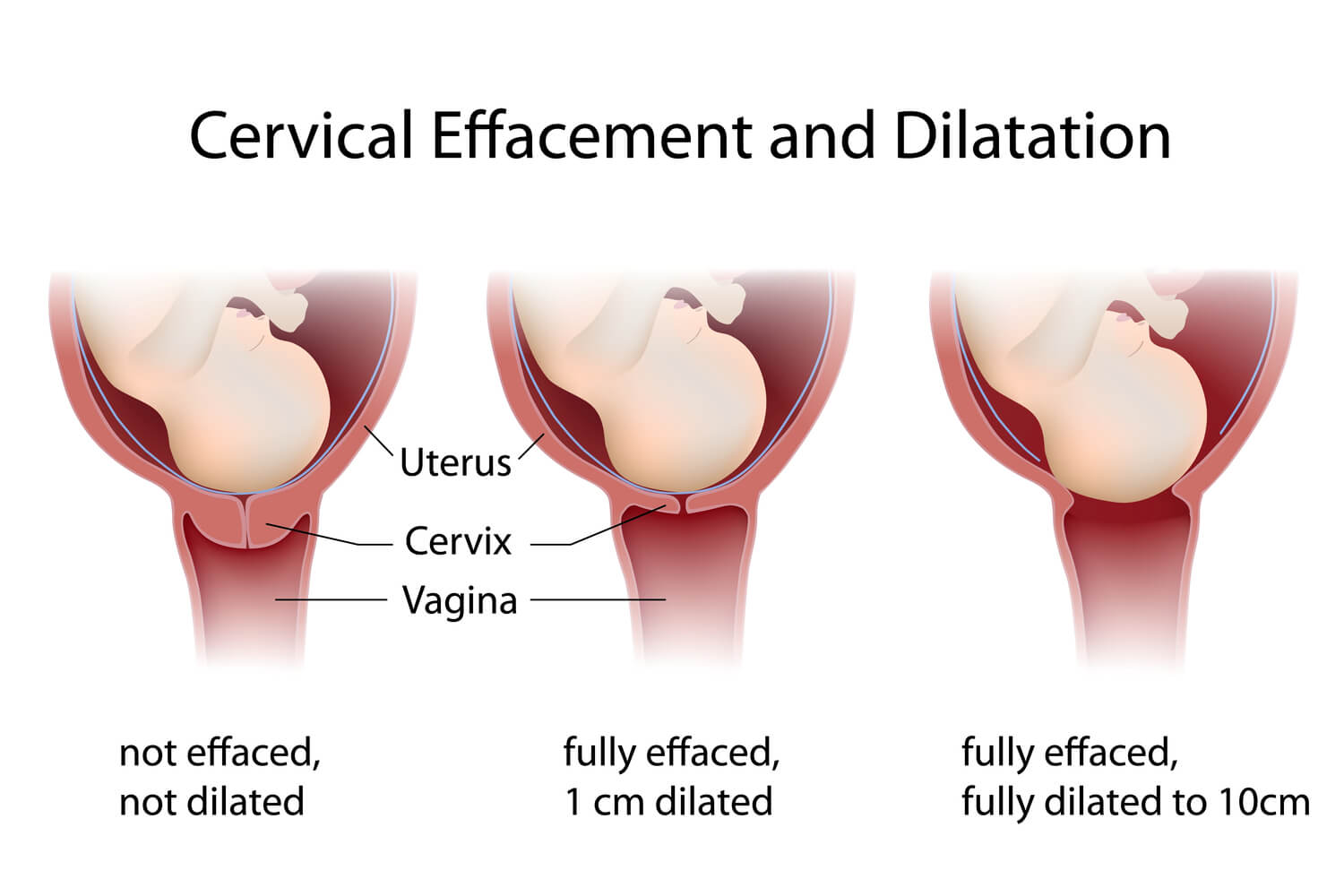 Cervix During