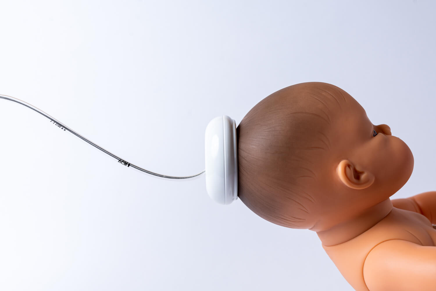 Vacuum Assisted Birth Everything You Need To Know Being The Parent