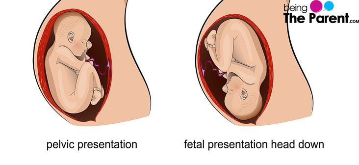 baby position