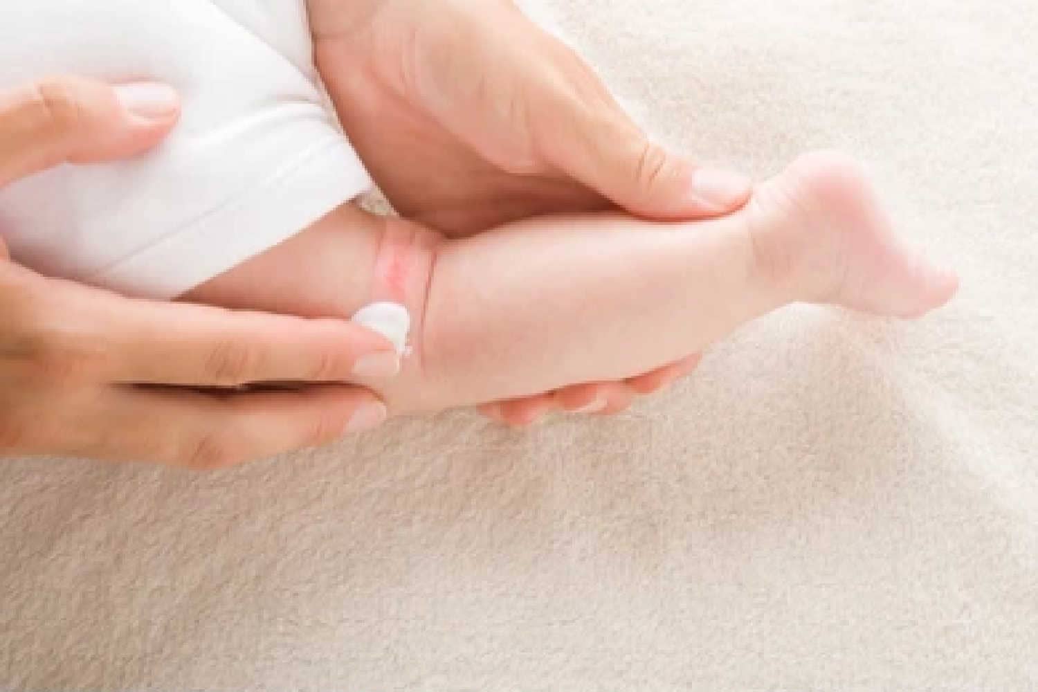 How To Treat Fungal Infection In Babies