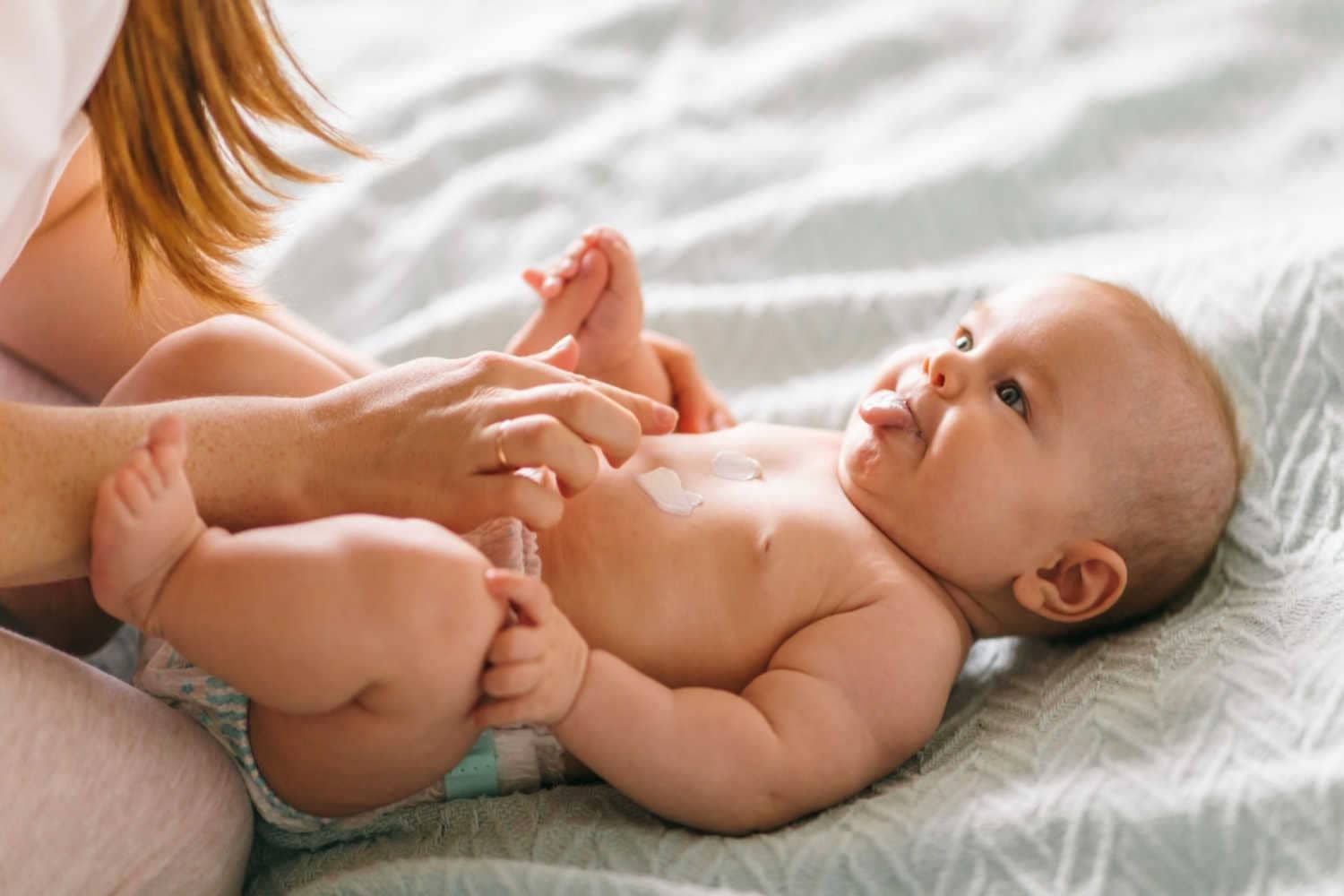 Treating Hives In Babies