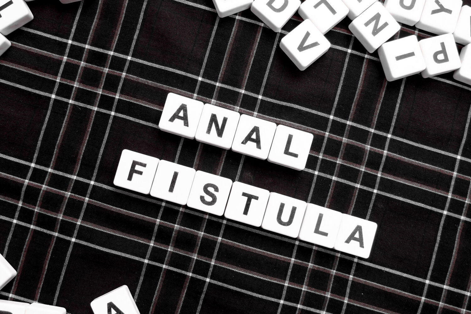 anal fistula