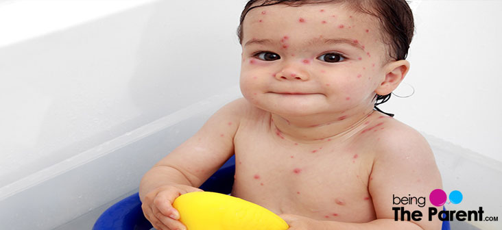 baby with infection