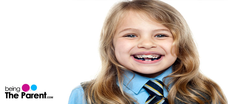 Dental braces for kids