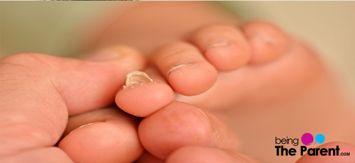 toe nail fungal infection
