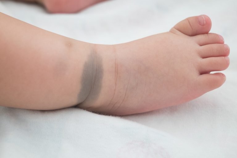 8 Common Skin Problems in Babies and Their Solutions Being The Parent