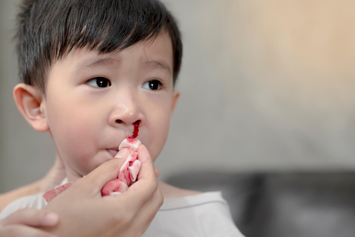 nose bleeds in toddlers