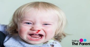 8 Unexpected Causes Of Nosebleeds In Toddlers nosebleed in toddlers