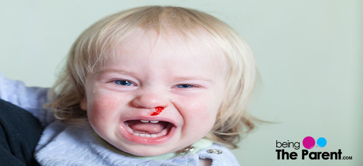 8 Unexpected Causes Of Nosebleeds In Toddlers | Being The Parent