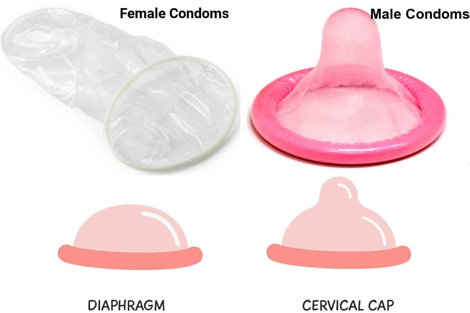 Barrier Contraception