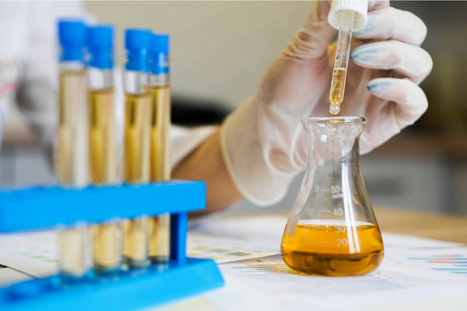 Urine Test And Urine Culture During Pregnancy