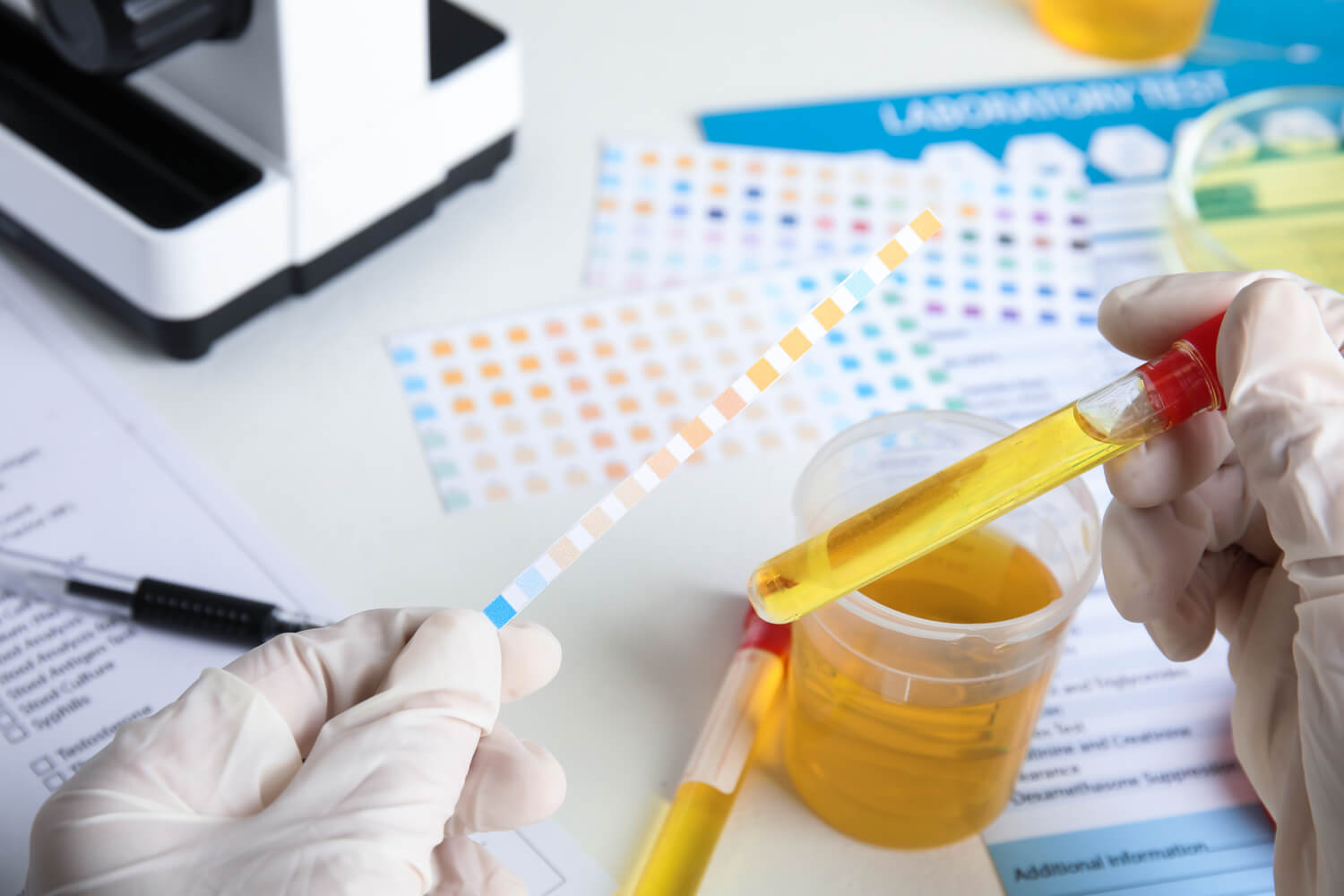What Can Urine Test Results Reveal_ 