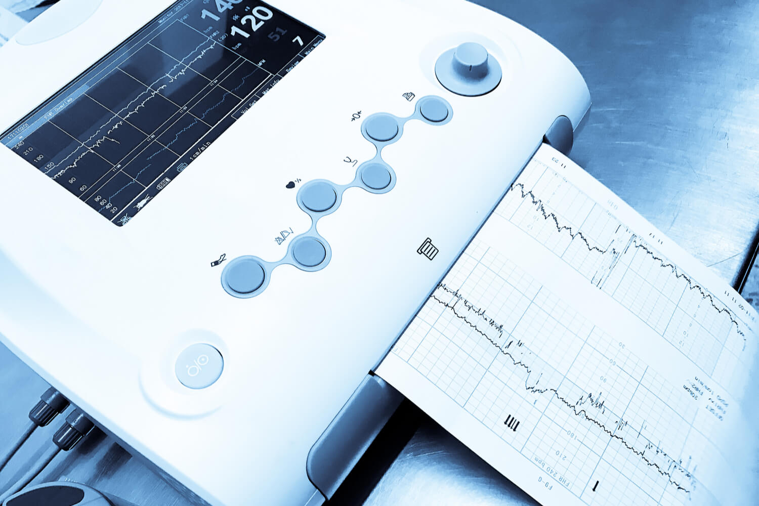 Fetal monitor showing fetal hear rate
