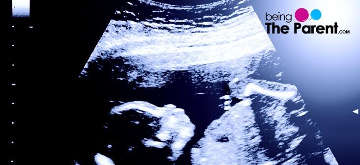 second-trimester-ultrasound-scan