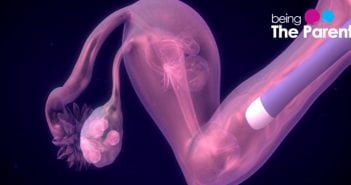 IS IVM A BETTER ALTERNATIVE TO IVF Ivm alternative for ivf