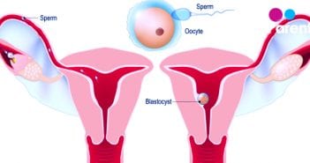 Implantation Bleeding – what are the signs to look out for Implantation Bleeding