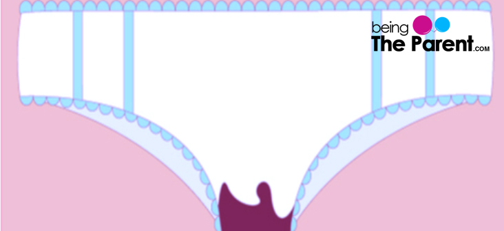 why is period blood black causes and treatments being the parent