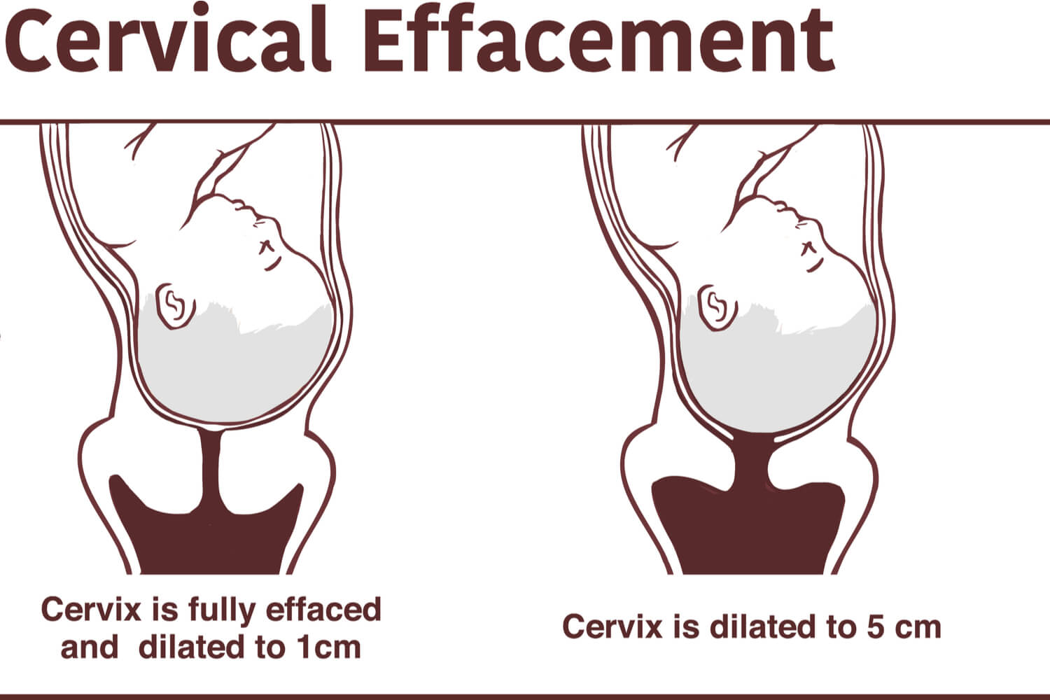 Cervical Effacement During Pregnancy Being The Parent