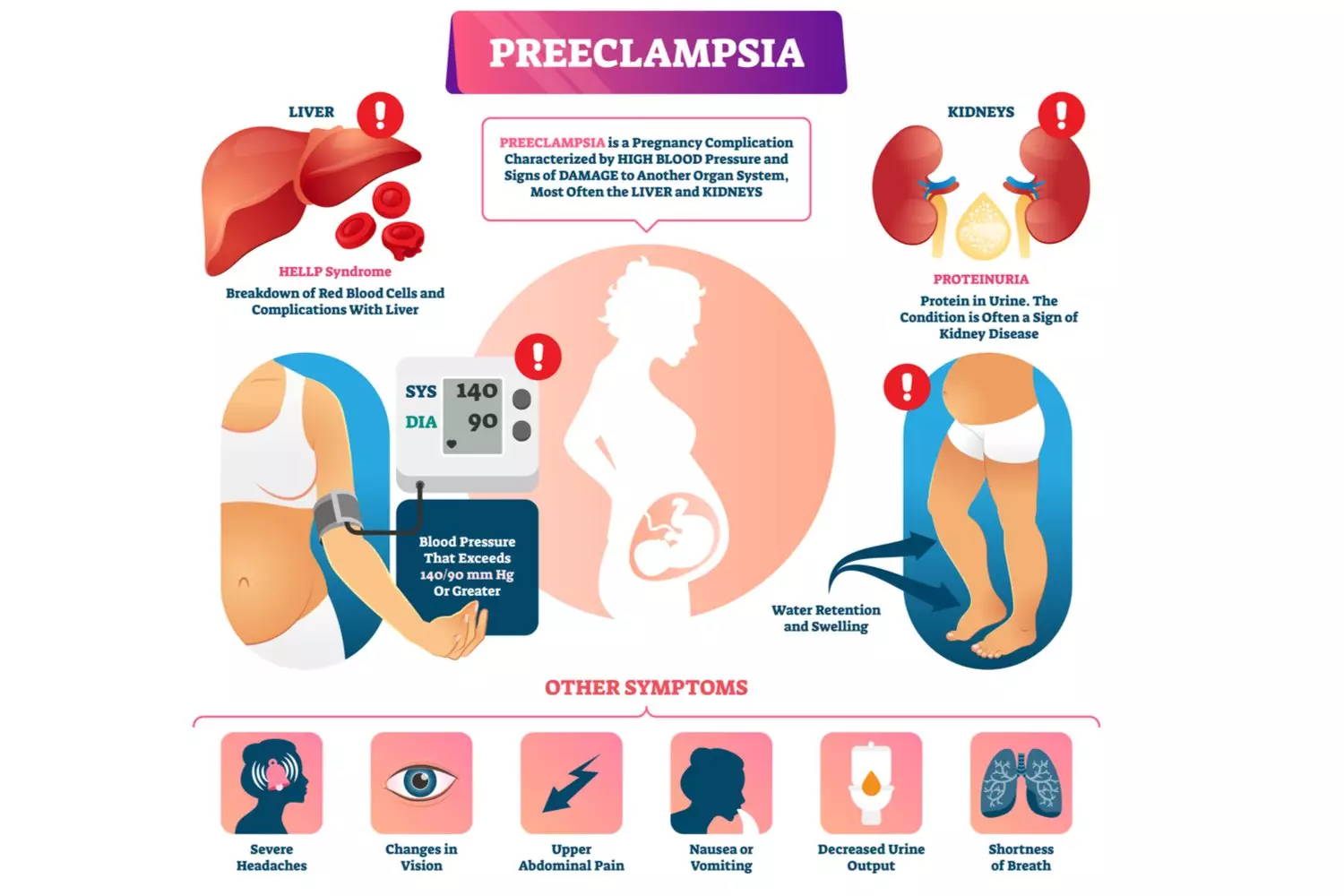 Preeclampsia in pregnancy