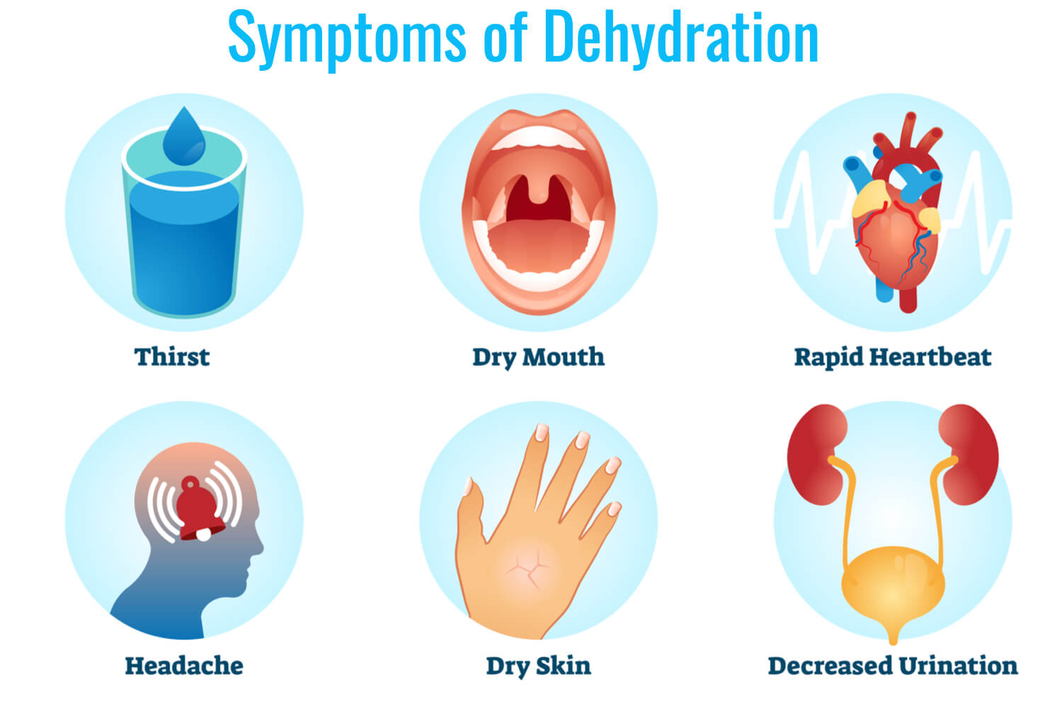 Symptoms of Dehydration During Pregnancy